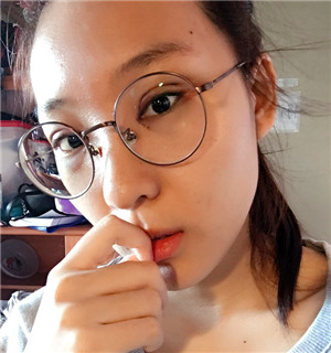 秦宏偉做的雙眼皮多項整形 丑小鴨的蛻變啊