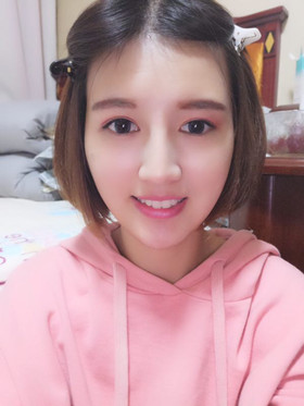 注射瘦臉去抬頭紋，找回屬于我的年齡，感謝金頌良醫(yī)生！