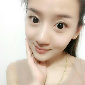 面部吸脂手術前后過程圖片,真實案例分享