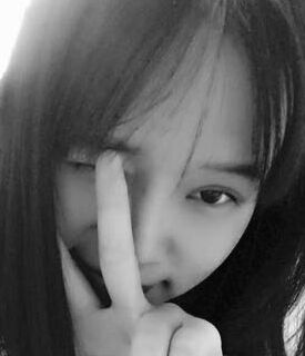 全切雙眼皮+去脂肪，終于擺脫小眼睛了