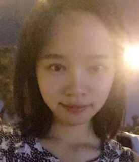 全切雙眼皮+去脂肪，終于擺脫小眼睛了