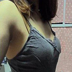 自體脂肪隆胸真的變大胸了 感謝成都天使之翼