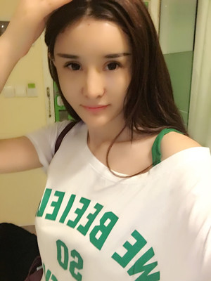 自體脂肪填充全臉后人生像開了掛