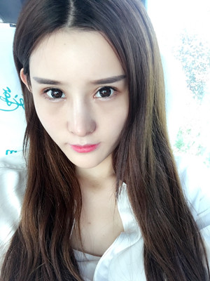 自體脂肪填充全臉后人生像開了掛