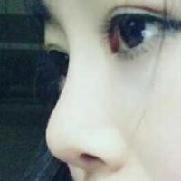 將自己隆鼻恢復(fù)過程分享給大家，希望對(duì)有需求的MM有幫助