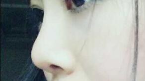 隆鼻手術(shù)過程分享