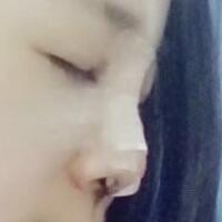 將自己隆鼻恢復(fù)過程分享給大家，希望對(duì)有需求的MM有幫助