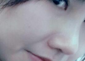 鼻子整形圖片分享