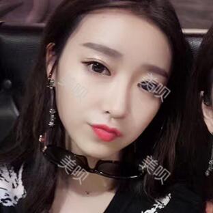 在成都天使之翼自體脂肪面部填充大家看看果怎么樣