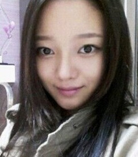 假體隆鼻手術過程前后對比圖片