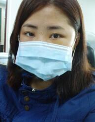 在北京炫美磨了下頜角 恢復(fù)紀(jì)實(shí)分享