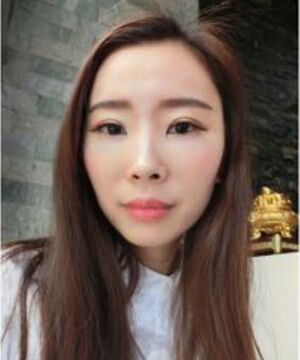 自體脂肪面部填充告別干癟消瘦的臉