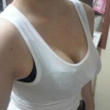 假體隆胸讓我告別小平胸 感謝北京彤美