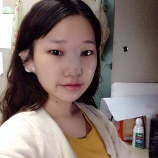 耳軟骨隆鼻改變了我的塌鼻梁 北京彤美做的果很棒