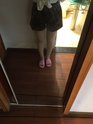 王世虎做的吸脂瘦大腿 果很明X