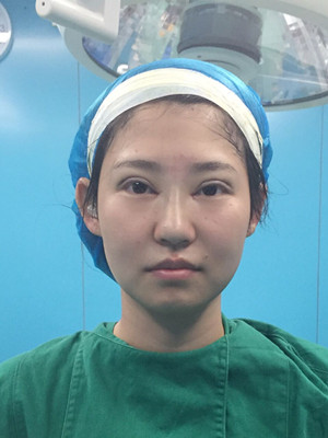 看了顏玲做的雙眼皮多項整形 你們心動了沒