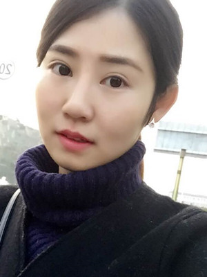 看了顏玲做的雙眼皮多項整形 你們心動了沒