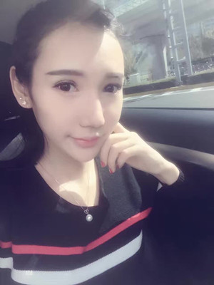 隆鼻整形做完之后人也美了 軍美顏玲做的