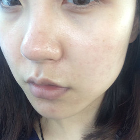 做了黑臉娃娃后，Duang的一下就變成“白雪公主”啦