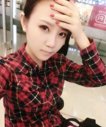 假體隆鼻15天后恢復(fù)果 杭州時(shí)光做的~