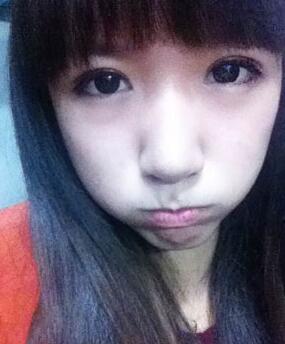 北京常好麗格三點定位雙眼皮恢復(fù)一個月經(jīng)歷