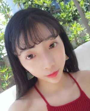 天津維美孫雪做的激光去雀斑后皮膚超干凈