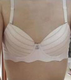 北京常好麗格三點定位雙眼皮恢復(fù)一個月經(jīng)歷