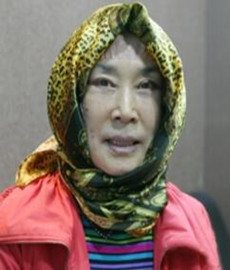 拉皮除皺手術讓我年輕20歲