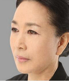 拉皮除皺手術讓我年輕20歲