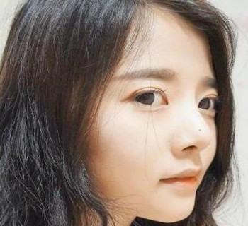 硅膠隆鼻手術圓了我高鼻梁的夢