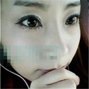 首爾麗格洪性范耳軟骨隆鼻案例