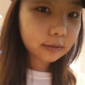 磨下頜角磨骨手術(shù)一個月了，分享一下恢復(fù)前后的果照片哇~