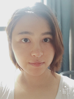 自體耳軟骨隆鼻后顏值上升了有沒(méi)有 莫琳娜葛紅做的