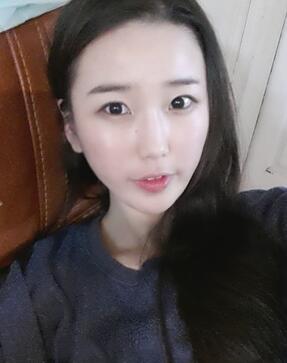 北京清木自體脂肪豐面頰2個月果分享