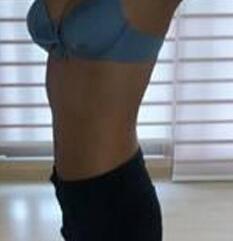 北京清木腰腹吸脂3個月感受