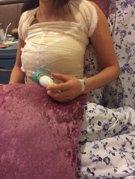 假體隆胸終于讓我擺脫了平胸妹的稱號，天津伊美爾熊斌做的