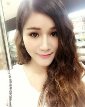 鼻頭巨大做了鼻翼縮小術(shù)后秀氣了不少