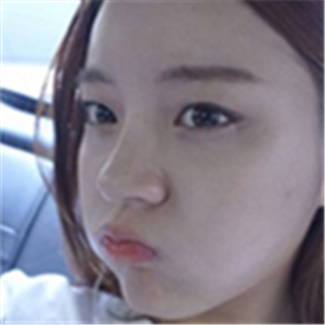 注射美白k氧注射針后一個(gè)療程的果照片，你們看前后對比，變化很大吧~