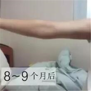 手臂吸脂手術(shù)八個月了，看看我的前后對比果圖片吧~~