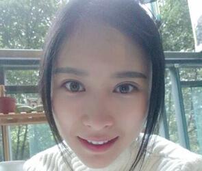 自體脂肪面部填充三個月了，恢復(fù)的很好，給你們看看果怎么樣吧，是不是很美麗了~