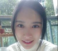 大腿吸脂做自體脂肪面部填充三個月了，分享給大家