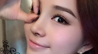 隆鼻整形后恢復(fù)圖