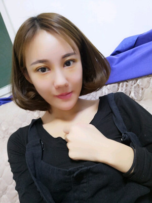 劉中策做的開內(nèi)眼角 眼睛好漂亮