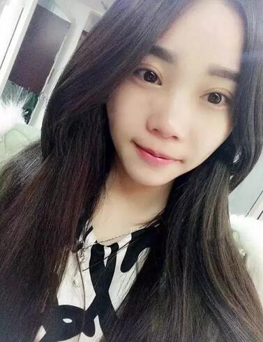 成都蜀尚蓉雅雙眼皮恢復(fù)紀(jì)實 看看果怎么樣