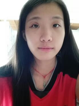 埋線雙眼皮15天恢復(fù)記錄