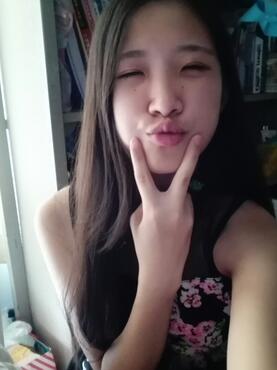 埋線雙眼皮15天恢復(fù)記錄