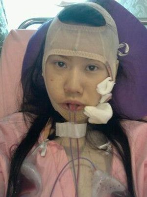 磨了下頜角和顴骨的我 變成小仙女了
