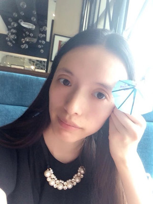 玻尿酸面部填充前后過程及對比圖片，來看看果如何