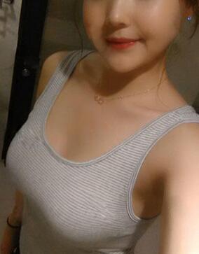 成都艾米麗自體脂肪隆胸三個月啦~