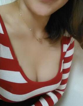 成都艾米麗自體脂肪隆胸三個月啦~